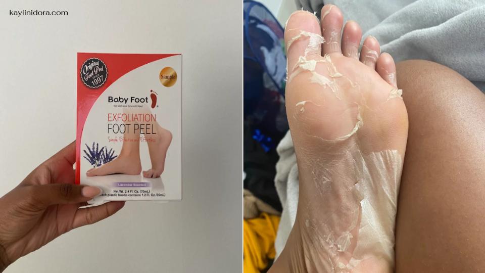 "Baby Foot Peel " หากเท้าของคุณมีแนวโน้มที่จะมีผิวแห้งและหนังด้าน การดูแลรักษาเท้าให้นุ่มและเรียบเนียนถือเป็นเรื่องที่ต้องดิ้นรนอย่างต่อเนื่อง
